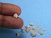 Kidney Stone: बिना ऑपरेशन पथरी अपने आप निकल जाएगी बाहर, आजमा लें ये 2 आयुर्वेदिक नुस्खे; दर्द से मिलेगा आराम 