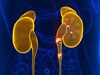 Kidney Stone: तपती गर्मी का खतरनाक असर! युवाओं में किडनी में पथरी के मामले 40% बढ़े