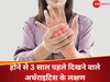 ये लक्षण 3 साल पहले ही दे देते हैं गठिया होने की चेतावनी, आप तो नहीं कर रहे इग्नोर