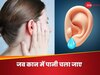 कान में पानी चला गया, कॉटन बड या माचिस की तीली यू न करें, ऐसे खोलें ब्लॉक्ड ईयर