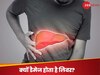 Liver Health: किन विटामिनों की कमी से डैमेज हो जाता है लिवर? कभी न होने दें कमी, करें इन चीजों का सेवन