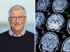 Bill Gates: इस जानलेवा दिमागी बीमारी से जूझ रहे हैं बिल गेट्स, बेटी Phoebe ने खोला ऐसा राज; जिसे जानकर हिल जाएंगे आप!