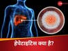 थकान, बुखार और कमजोरी.. ये हैं इस पेट की बीमारी के लक्षण; जो बन सकती है लिवर कैंसर और फेलियर का कारण