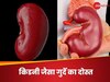 किडनी जैसा दिखने वाला ये एक फूड, गुर्दे की बीमारियों मे कैसे बन जाता है हकीम?