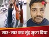 Zepto डिलीवरी बॉय ने कस्टमर को मारे इतने मुक्के कि फूट गई खोपड़ी, जानें क्यों हुआ झगड़ा?