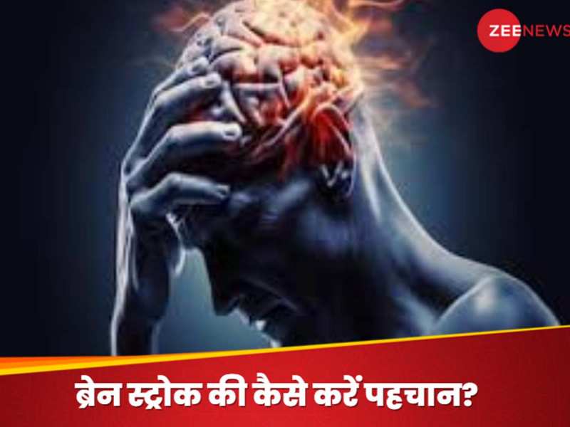 ब्रेन स्ट्रोक होने पर कौन से 3 लक्षण सबसे पहले आते हैं नजर? भूलकर भी मत करना इग्नोर
