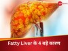 चुपचाप आपके जिगर को अंदर से खा रही ये गलत आदतें, जानें Fatty Liver के 4 बड़े कारण