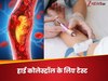 हाई कोलेस्ट्रॉल का कच्चा चिट्ठा खोलकर रख देगा ये इकलौता टेस्ट, दिल की सेहत का भी लगेगा पता