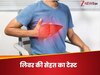 आपका लिवर ठीक से काम कर रहा है या नहीं? ये एक छोटा सा ब्लड टेस्ट खोल देगा राज़
