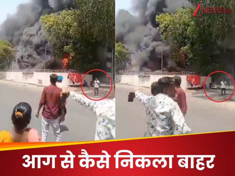 भयंकर आग से निकलते दिखे बाहर, प्लेन क्रैश में बचने वाले विश्वासकुमार का नया VIDEO