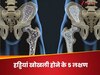 हड्डियों को खोखला कर चूरा बना देती है ये एक बीमारी, 5 लक्षण दिखें तो जाएं डॉक्टर के पास
