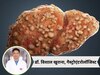 Explainer: इम्यूनोथेरेपी क्या है? बिना ट्रांसप्लांट सिरोसिस से सड़े लिवर को ठीक किया जा सकता है? जानें गैस्ट्रोएंटरोलॉजिस्ट की राय
