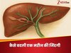 पित्त की नली में परेशानी, डॉक्टर ने किया मैग्नेटिक तकीनक का यूज, नहीं पड़ी लिवर सर्जरी की जरूरत