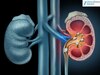 Kidney Stone: ਗਲੇ 'ਚੋਂ ਲੰਘਦੇ ਹੀ ਗੁਰਦੇ ਦੀ ਪੱਥਰੀ ਬਣ ਸਕਦੀ ਹੈ ਇਹ 10 ਚੀਜ਼ਾਂ, ਹੋ ਜਾਓ ਸਾਵਧਾਨ!