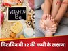  विटामिन बी 12 की कमी से शरीर में दिखते हैं ये लक्षण, अनदेखी से खोखला हो सकता है शरीर! 