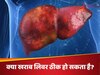 क्या सड़ा हुआ लिवर हो सकता है ठीक? जानें बर्बाद कलेजे को फिर से सही करने के ये आसान उपाय!  