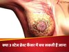 क्या थर्ड स्टेज ब्रेस्ट कैंसर में बच सकती है जान, कहीं फर्स्ट स्टेज के लक्षणों की अनदेखी तो नहीं इलाज में रुकावट! 