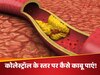 शरीर में कोलेस्ट्रॉल बढ़ने पर आजमा सकते हैं ये असरदार उपाय, नसों में तेजी से खून करेगा पंप! 