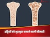 हड्डियों को अंदर से कमजोर कर भुरभुरा बना देती है ये खतरनाक बीमारी, खत्म हो जाती है शरीर की ताकत