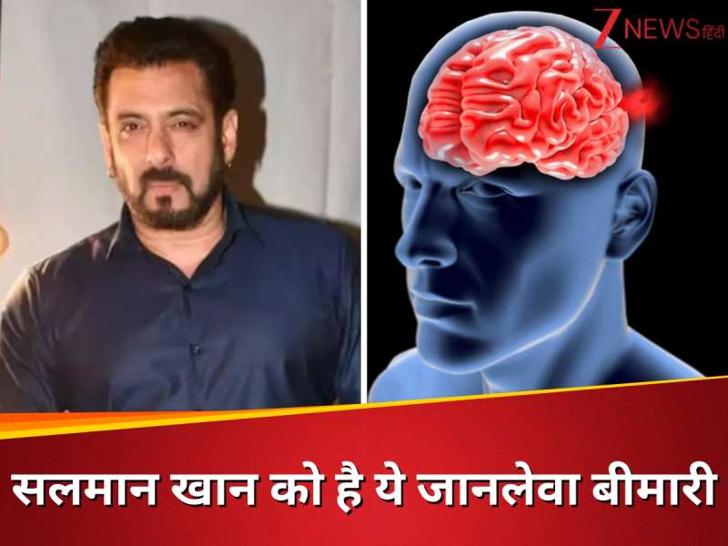 Salman Khan is suffering from brain aneurysm symptoms causes know all about  this silent killer | Brain Aneurysm: सलमान खान की बीमारी 'साइलेंट किलर' से  कम नहीं, समय पर न पकड़ा तो