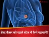 100 की उम्र में इस 1 लक्षण से फर्स्ट स्टेज पर पहचाना ब्रेस्ट कैंसर, बिना किमोथेरेपी हुईं कैंसर फ्री