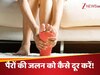 किस विटामिन की कमी से तलवों में होती है जलन? जानें इससे राहत पाने के आसान उपाय!