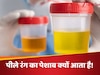 गर्मियों में पीला पेशाब इन 4 बीमारियों का है संकेत, नजरअंदाज करने की गलती जान पर पड़ सकती है भारी!  