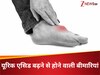 गठिया ही नहीं, यूरिक एसिड बढ़ने पर ये खतरनाक बीमारियां भी हो जाती हैं सुपर एक्टिव
