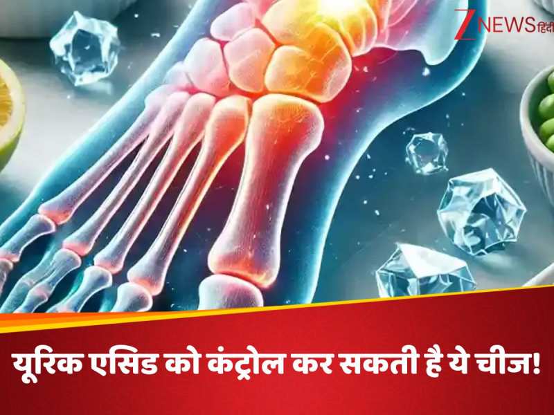 शरीर को अंदर से गला देगी हाई यूरिक एसिड की बीमारी, कंट्रोल करने के लिए खाएं ये चीज!