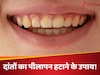 नींबू से इस तरह करें पीले दांतों की सफाई, सफेद मोती जैसे चमक जाएंगे आपके दांत!