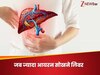 लिवर की वो बीमारी जिसमें ये अंग हद से ज्यादा आयरन सोखने लगता है, हो सकता है जान का खतरा