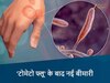 बारिश के चलते स्किन इंफेक्शन ने बढ़ाई चिंता