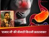पंचायत के 'दामाद जी' को जो बीमारी हुई थी, क्या उसका हार्ट अटैक से कोई रिश्ता है?