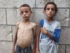 Gaza Starvation: भूख से मर रहा है गाजा? चैरिटी फाउंडेशन्स ने की बड़ी अपील