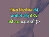 Due to deficiency of which vitamin veins of the legs swell up during sleep