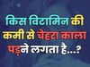 Due to deficiency of which vitamin the face starts turning dark