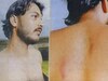 Delhi: अधमरा होने तक इमरान को पीटती रही पुलिस, हैरान कर देगा जाकिर नगर का ये केस