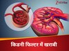 Glomerular Diseases: वो बीमारी जिसमें खराब होने लगते हैं गुर्दे के फिल्टर, किडनी फेलियर का हाई रिस्क, ये 5 लोग रहे सावधान