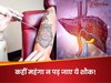 सजने-संवरने की ये चाह कहीं ले न डूबे! टैटू से भी बढ़ रहा है हेपेटाइटिस B और C का खतरा, जानें कैसे