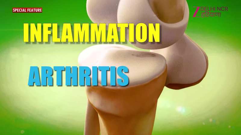 विश्व गठिया दिवस.. भरोसे और खुशी से संभव दर्दमुक्त जीवन, Arthritis पर एक्सपर्ट्स ने क्या कहा?