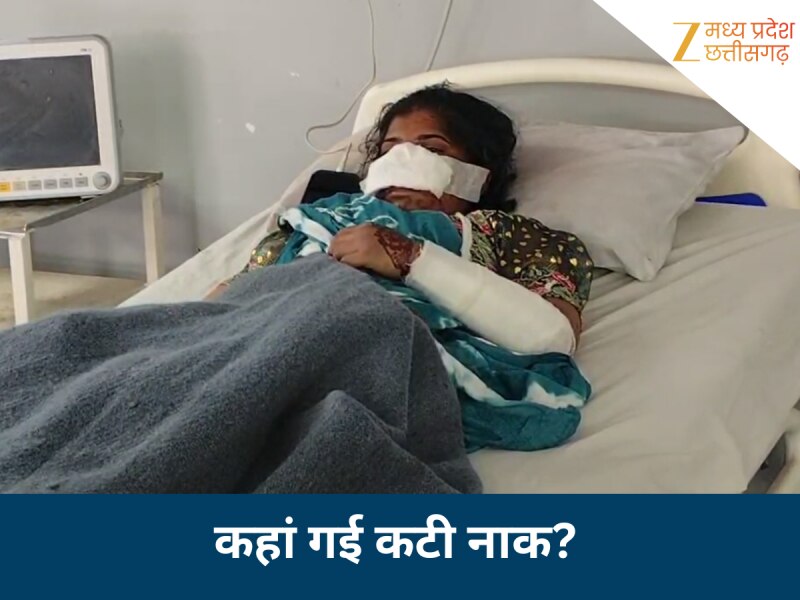 बौखलाए पति ने काटी पत्नी की नाक, फिर जो हुआ वो और भी खतरनाक; अब नहीं मिल रहा कटा अंग