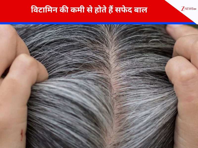इस विटामिन की कमी से होते हैं सफेद बाल, जानें बचाव का तरीका!