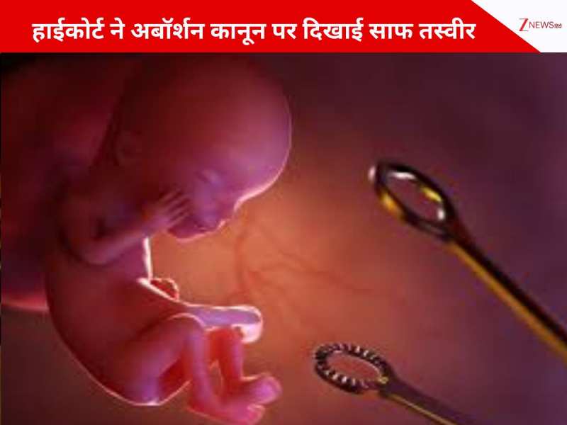 शादी के बाद भी क्यों खत्म नहीं होती महिला की फ्रीडम? जानें अबॉर्शन पर HC का फैसला