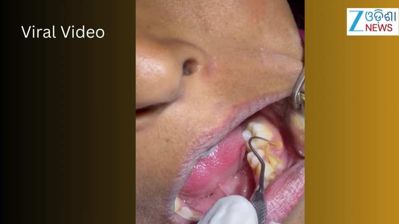 Video: ଦାନ୍ତ ସମସ୍ୟାର ବଡ କାରଣ କହିଲେ ଡାକ୍ତର, ଭିଡିଓ ହେଲା ଭାଇରାଲ୍